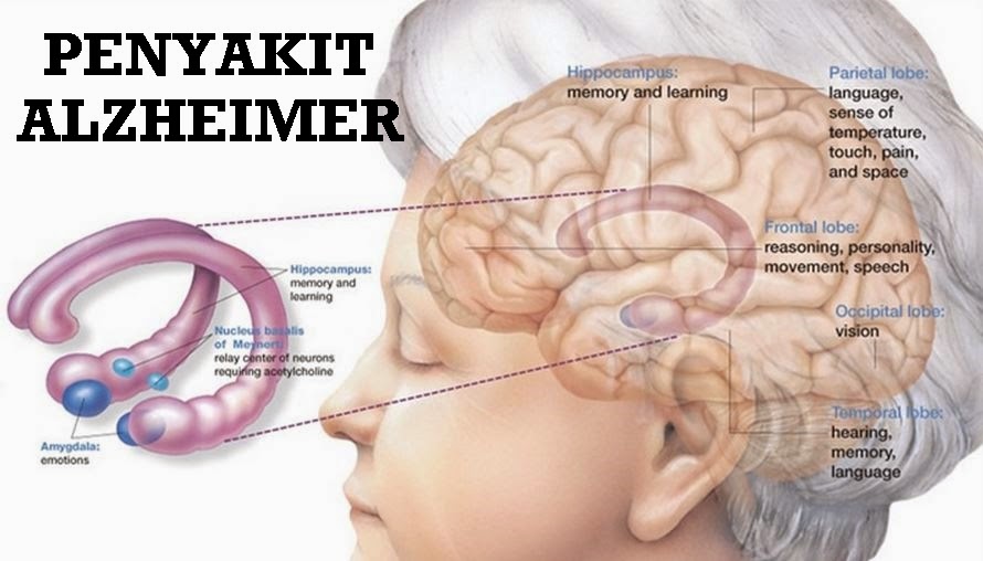 Membantu mengobati penyakit Alzheimer